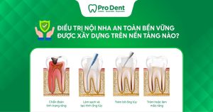 Điều trị nội nha an toàn bền vững được xây dựng trên nền tảng nào?