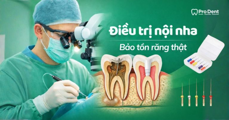 Tầm quan trọng của điều trị nội nha trong bảo tồn răng thật và phòng ngừa biến chứng