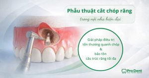 Phẫu thuật cắt chóp răng trong nội nha hiện đại