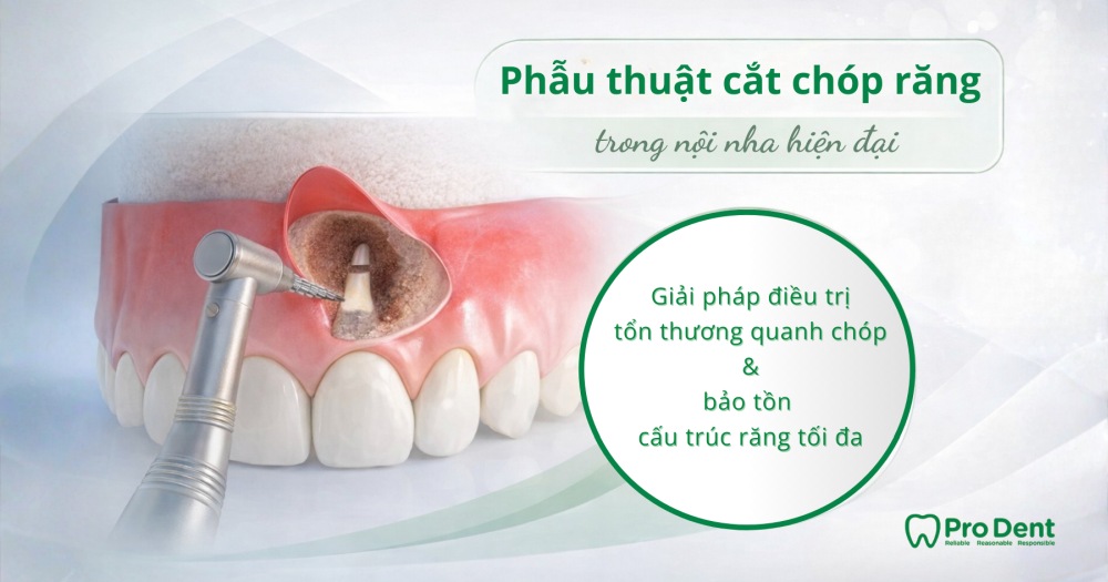 Phẫu thuật cắt chóp răng trong nội nha hiện đại