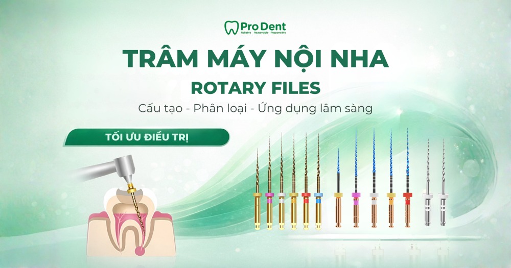 Trâm máy nội nha: Cấu tạo, phân loại và ứng dụng lâm sàng