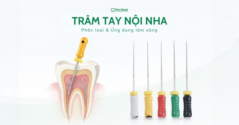 TRÂM TAY NỘI NHA: PHÂN LOẠI VÀ ỨNG DỤNG TRONG ĐIỀU TRỊ TỦY