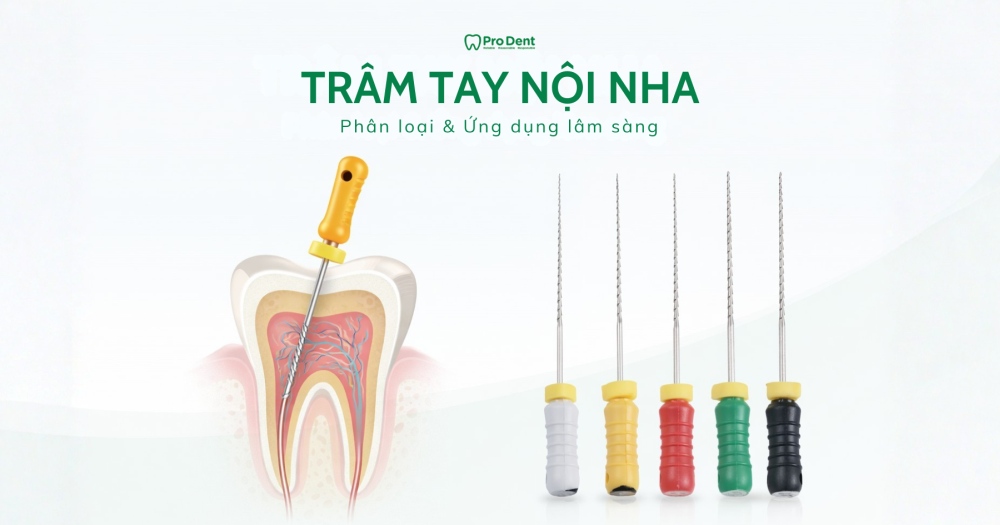 TRÂM TAY NỘI NHA: PHÂN LOẠI VÀ ỨNG DỤNG TRONG ĐIỀU TRỊ TỦY